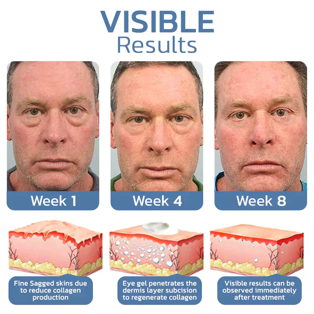 Skinhealth™ Awaken Peptide Lifting Eye Gel