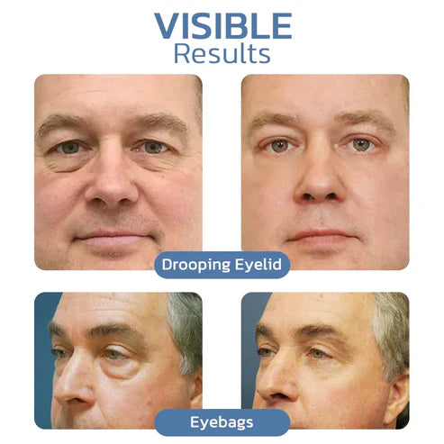 Skinhealth™ Awaken Peptide Lifting Eye Gel