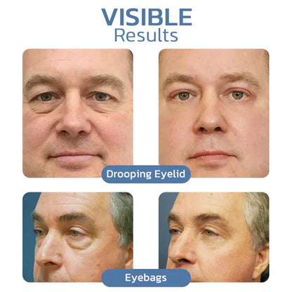 Skinhealth™ Awaken Peptide Lifting Eye Gel